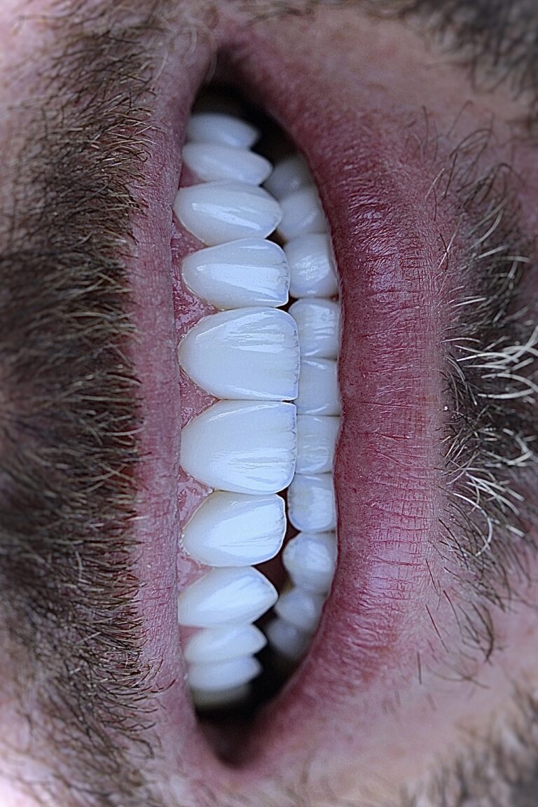 FullSizeRender